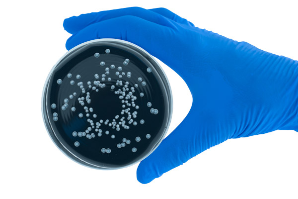 Legionella